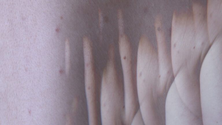 Zdjęcie przedstawiające pomarszczoną, ludzką skórę.